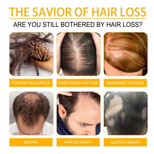Biotin Haarspray