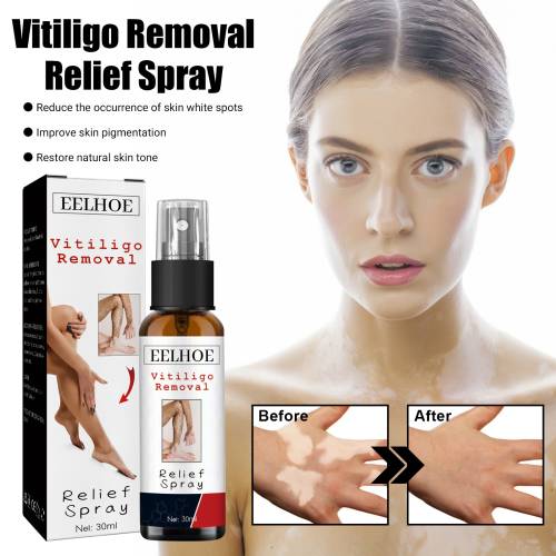 Kräuter-Hautspray für einen ebenmäßigen Teint