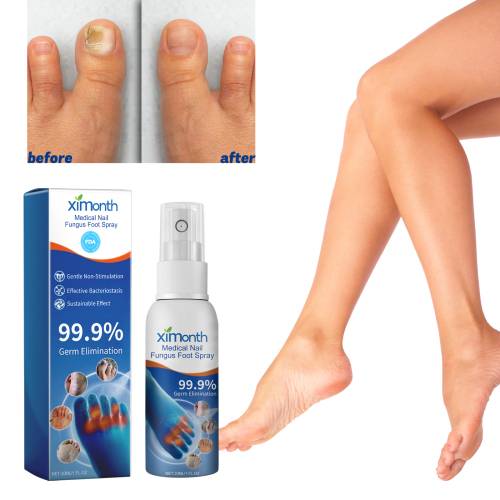 Kräuter Fuß- und Nagelspray