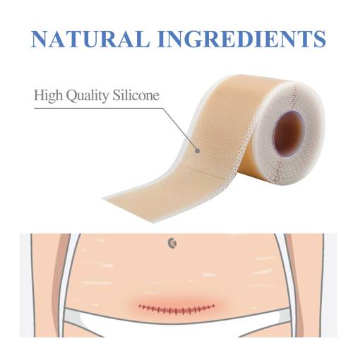 Silikon-Gel Folien