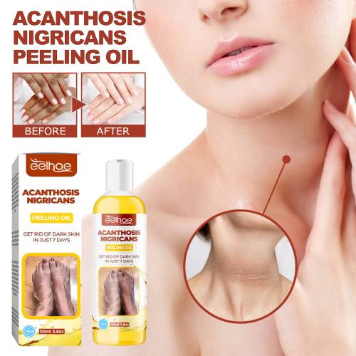 Peeling-Körperöl für Achseln, Ellbogen und Knie