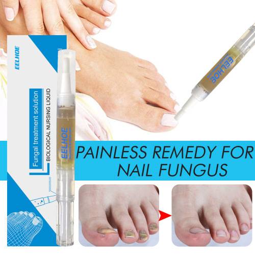Jojoba Pfefferminz Nagelpflege-Lösung