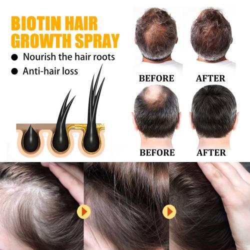 Biotin Haarspray