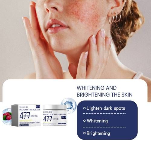 Kojisäure Creme gegen Pigmentflecken