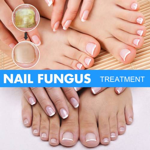 Kräuter Nagelpflege-Lösung