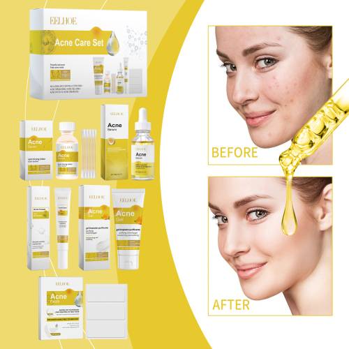 Pflegeset für unreine Haut