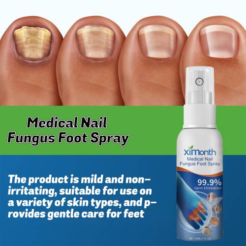 Kräuter Fuß- und Nagelspray